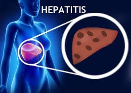 combatir hepatitis